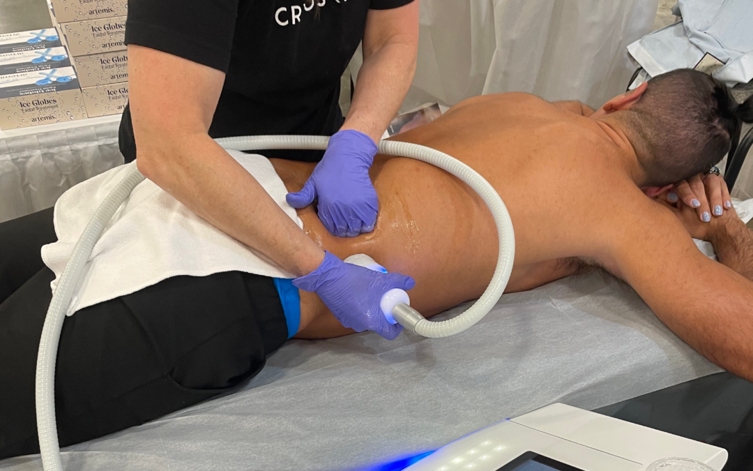 Frozen Perfection: CryoSlim vs. CryoTone Smackdown!