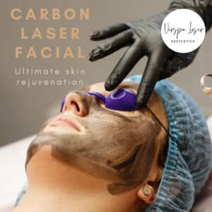 Carbon Laser Facial Skin Rejuvenation Anti Aging Skin Care Med Spa in NY - Laser Aesthetic Treatment Verspa a Medical Spa in New York