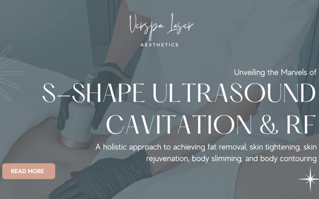 Marvels of S-Shape Ultrasound Cavitation & RF in NY Aesthetics