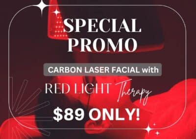 Carbon Laser Facial Skin Rejuvenation Anti Aging Skin Care Med Spa in NY - Laser Aesthetic Treatment Verspa a Medical Spa in New York