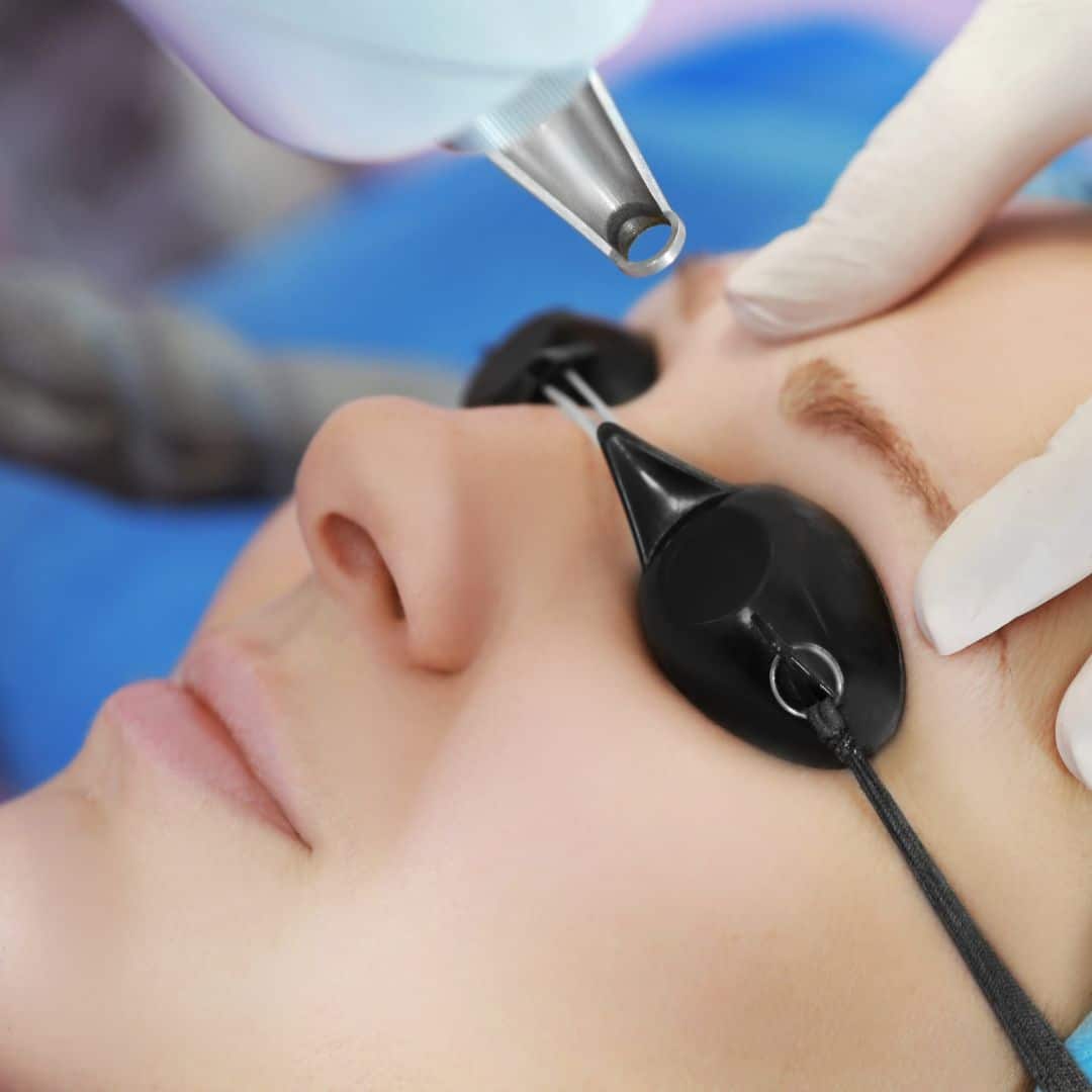 Skin Rejuvenation, Skincare Treatment, Anti-Aging Treatment, Facials, Facial Service, Acne Scars, Signs of Aging - Med Spa in NY - Verspa Laser Aesthetic a Medical Spa in New York